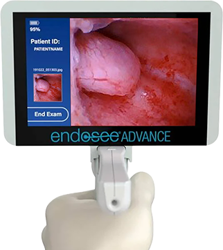 Endosee-handheld-version2